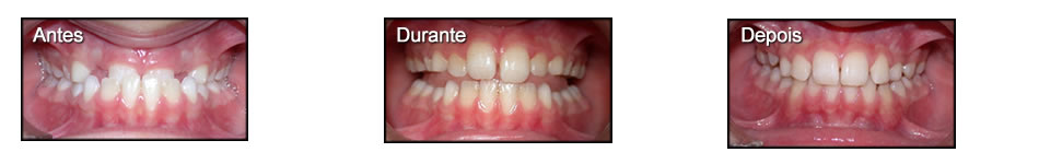 Clinica T: Ortodontia