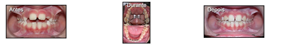 Clinica T: Ortodontia